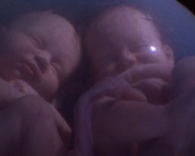 Twins in the womb