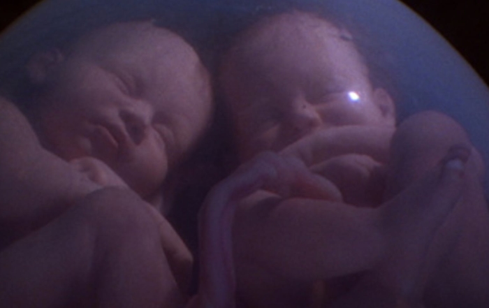 Twins in the womb